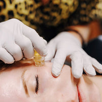 AquaGold Microchanneling For Ultimate Pre-Event Skin (A.K.A. “The Un-Facial, Facial.”)