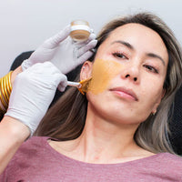 All Things Cosmelan Peel With Before and After Photos