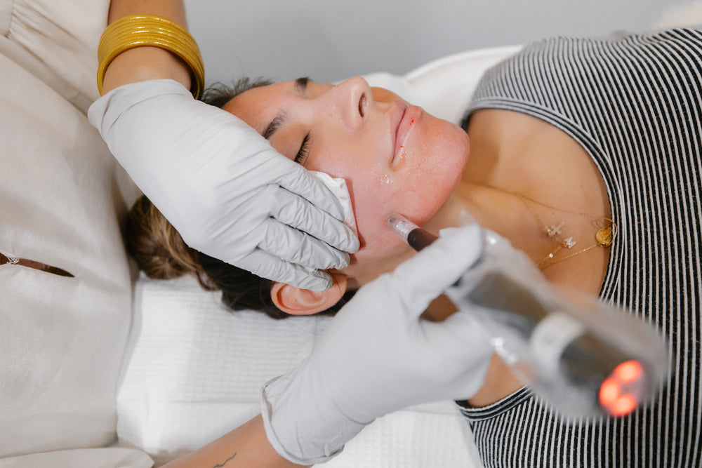 Microneedling - Treatment to Improve Skin Texture & Firmness in San Diego Featured Image