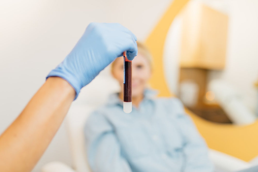 PRF Injections in San Diego Featured Image
