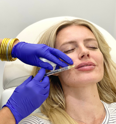 The Lip Guide—Featuring Lip Filler Before and Afters