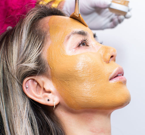 All Things Cosmelan Peel With Before and After Photos