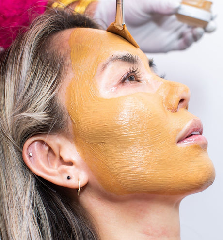 All Things Cosmelan Peel With Before and After Photos