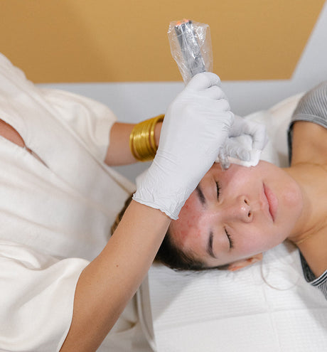 Radiofrequency Microneedling or Morpheus 8 -  Is There a Difference?