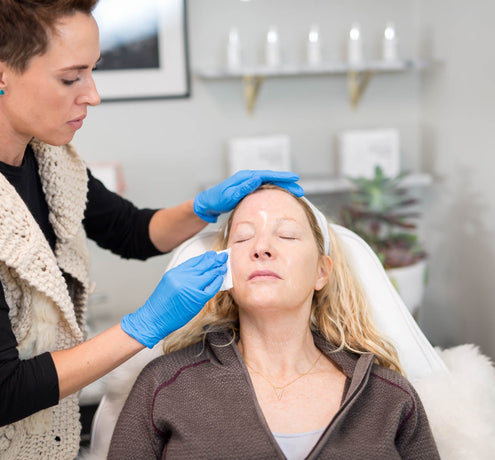 Peels That Can Do It All – Meet the VI Chemical Peel