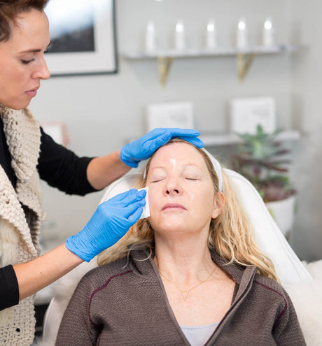 Peels That Can Do It All – Meet the VI Chemical Peel