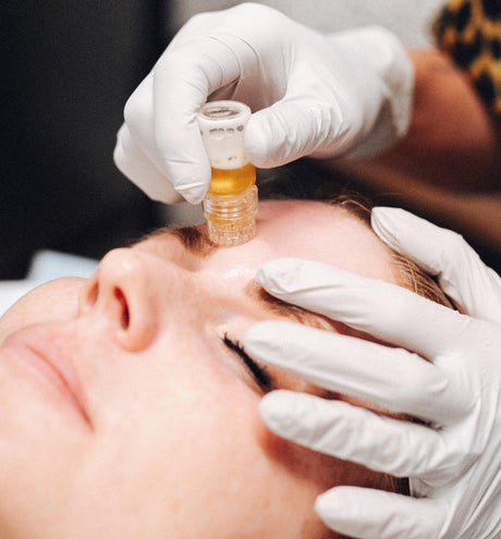 AquaGold Microchanneling For Ultimate Pre-Event Skin (A.K.A. “The Un-Facial, Facial.”)