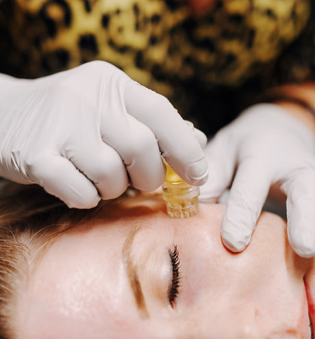 Harnessing Your Skin's Healing Powers: PRP & PRF