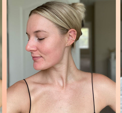 Tackling Melasma on the Face