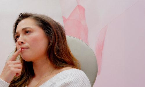 The Modern Guide to Lip Filler: Natural Results, Migration, Dissolving, and Choosing the Right Approach Featured Image