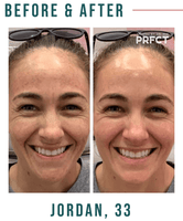 Client Case Study: Jordan with Melasma