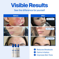 Magic Molecule The Solution - Hypochlorous Acid Skin Spray