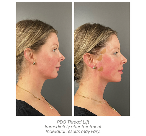 The Post-Weight Loss Glow-Up Guide: Improving Sagging Skin & Facial Hollowing