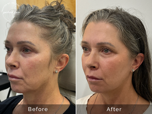 Before & After Gallery – PRFCT