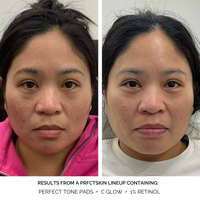 C Glow Before & After 1