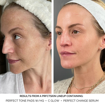 Perfect Change Serum: Age-Defying + Resurfacing Treatment with 1