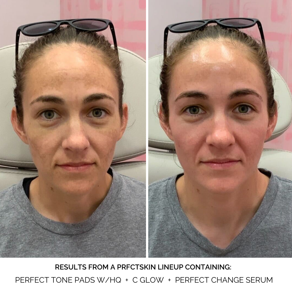 Perfect Change Serum Before & After 2