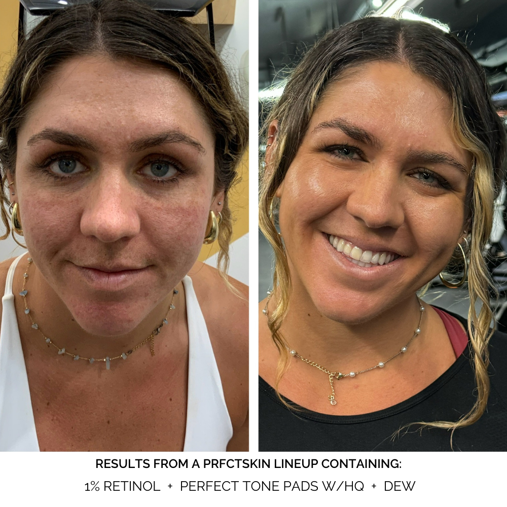 Perfect Tone Pads: Discoloration Fading + Brightening Pads with Kojic Acid | Alpha-Arbutin - View 7
