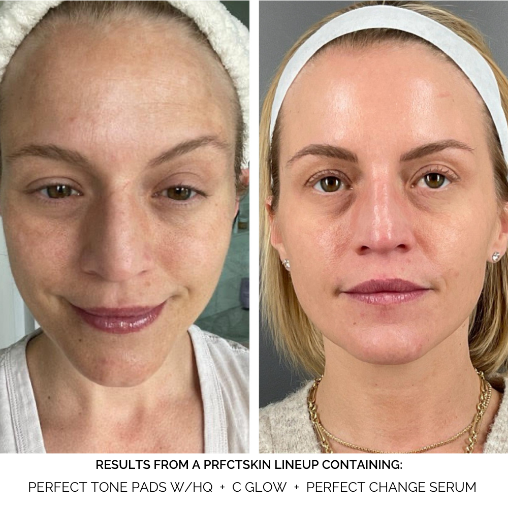 Perfect Tone Pads: Discoloration Fading + Brightening Pads with Kojic Acid | Alpha-Arbutin - View 2