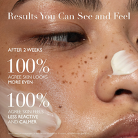 Omorovicza Soothing Salve: Calm & Strengthen - Ceramide NP | Antioxidant Complex