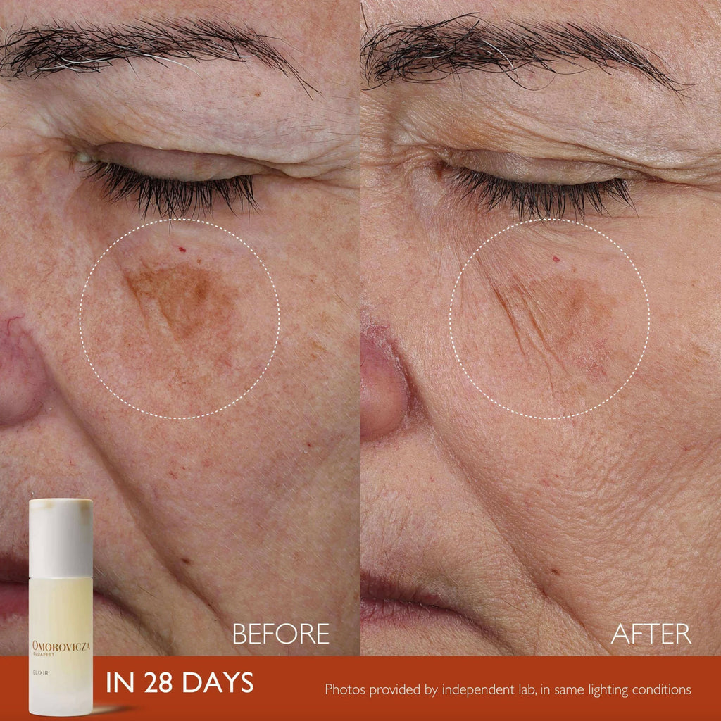 Omorovicza Elixir