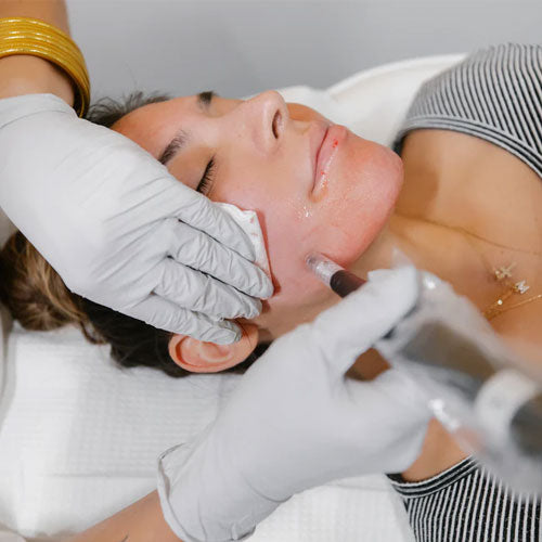 Microneedling